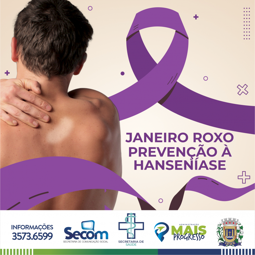 Janeiro Roxo: Perguntas frequentes sobre a Hanseníase - Escola