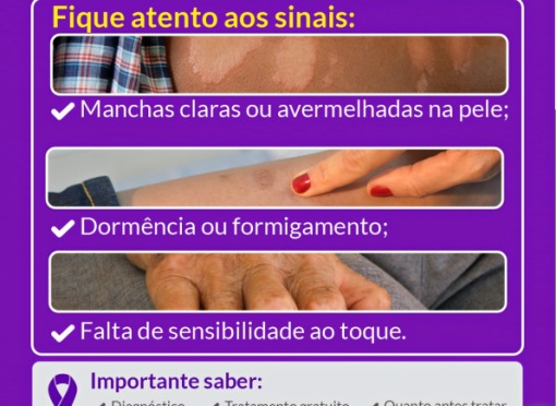 Janeiro Roxo – Mês da Prevenção à Hanseníase - Programação